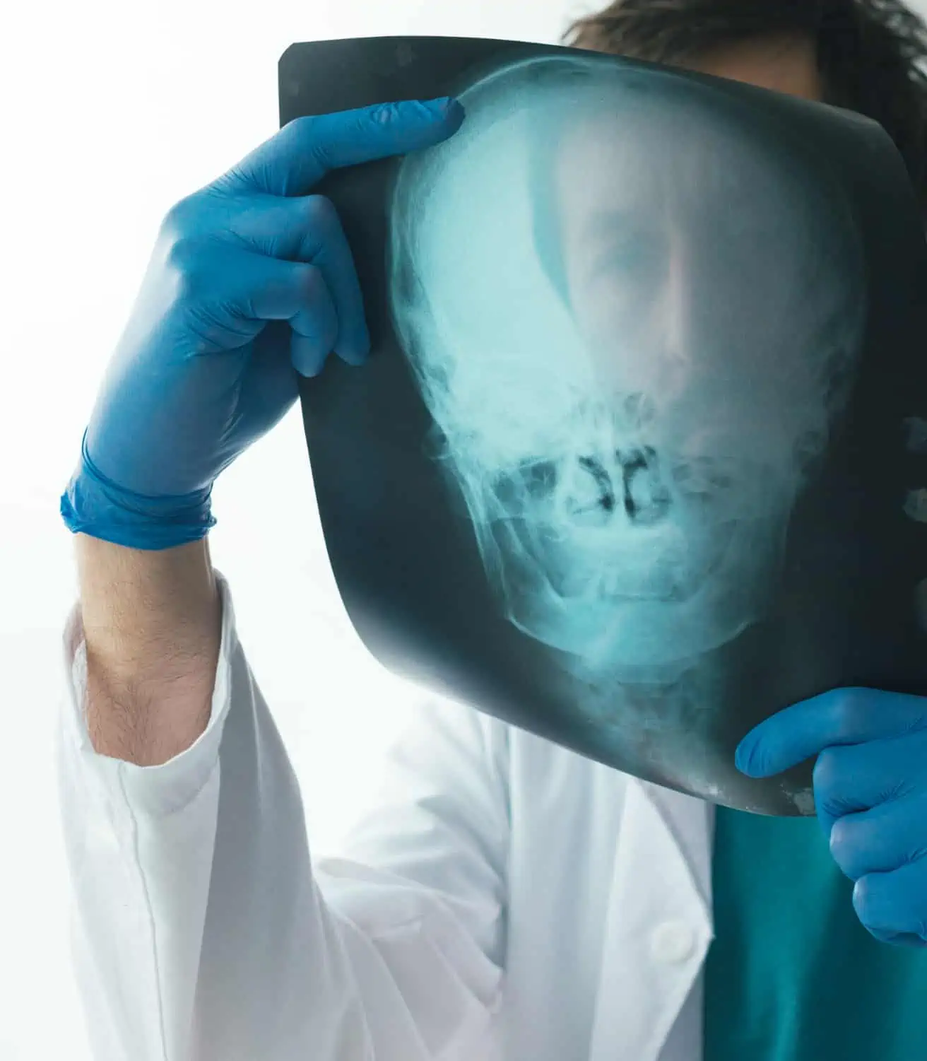 Doctor Reviewing X Ray report of skull